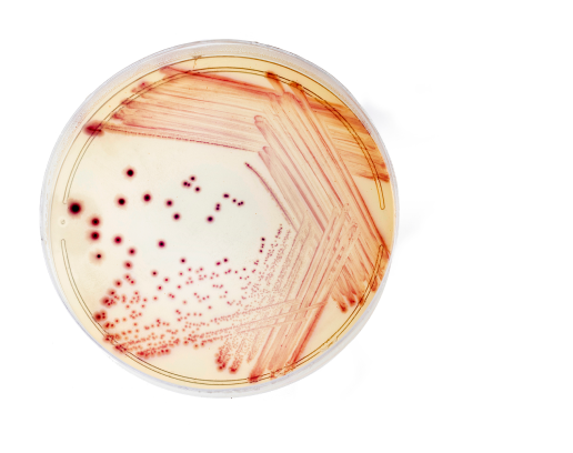 A petri dish with red lines and dots from a food pathogen.