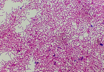 red food borne illness pathogens under a microscope.